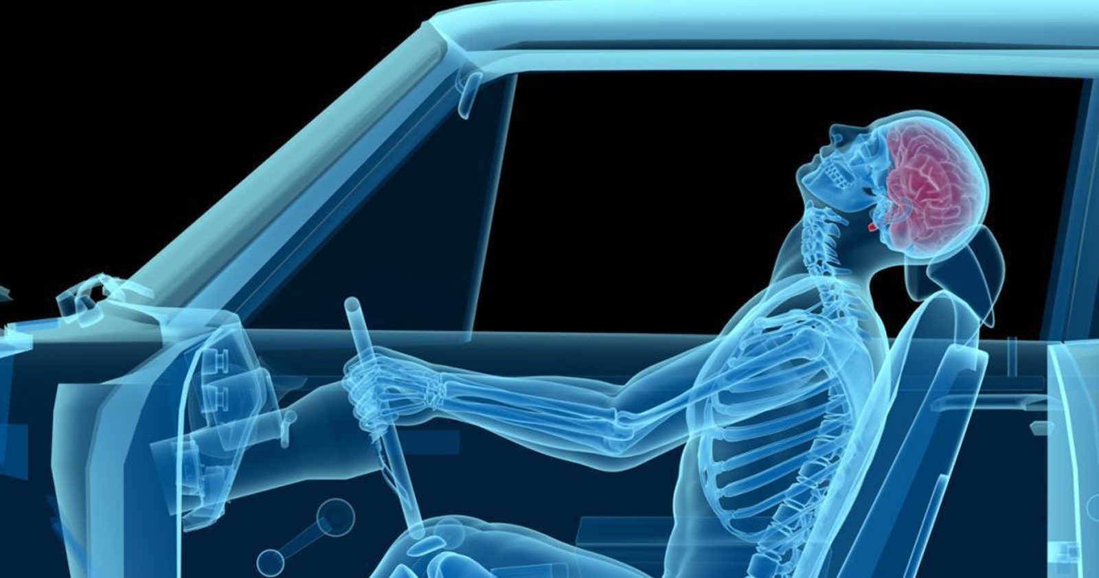 Car injury whiplash animation